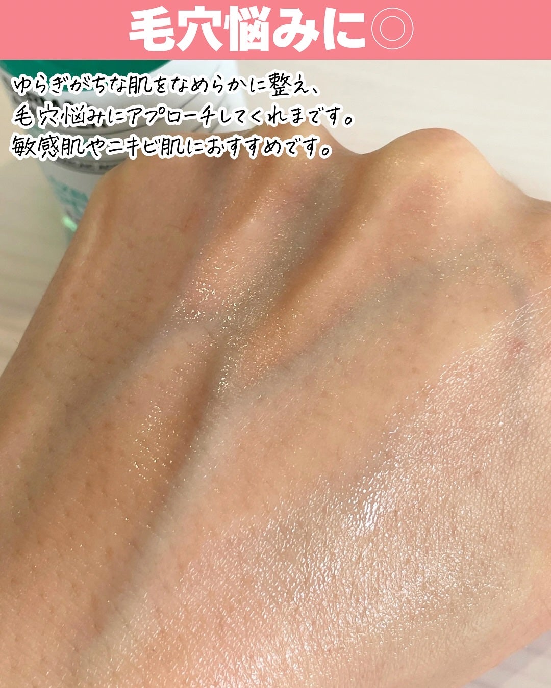 ダーマアンサーアゼライン酸ミントアンプル/CNP Laboratory/美容液を使ったクチコミ(4枚目)