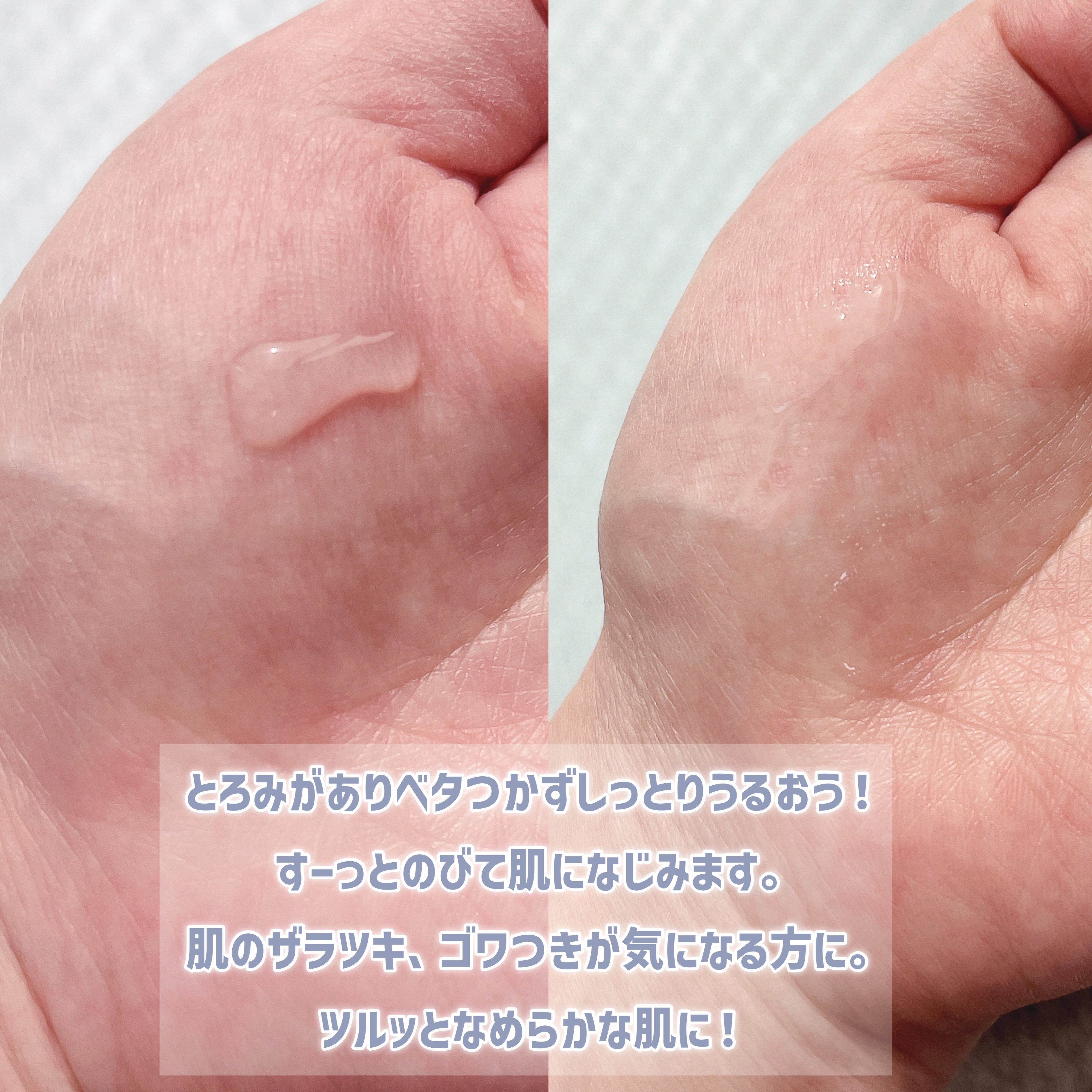 エファクラ ピールケア セラム/ラ ロッシュ ポゼ/美容液を使ったクチコミ（3枚目）