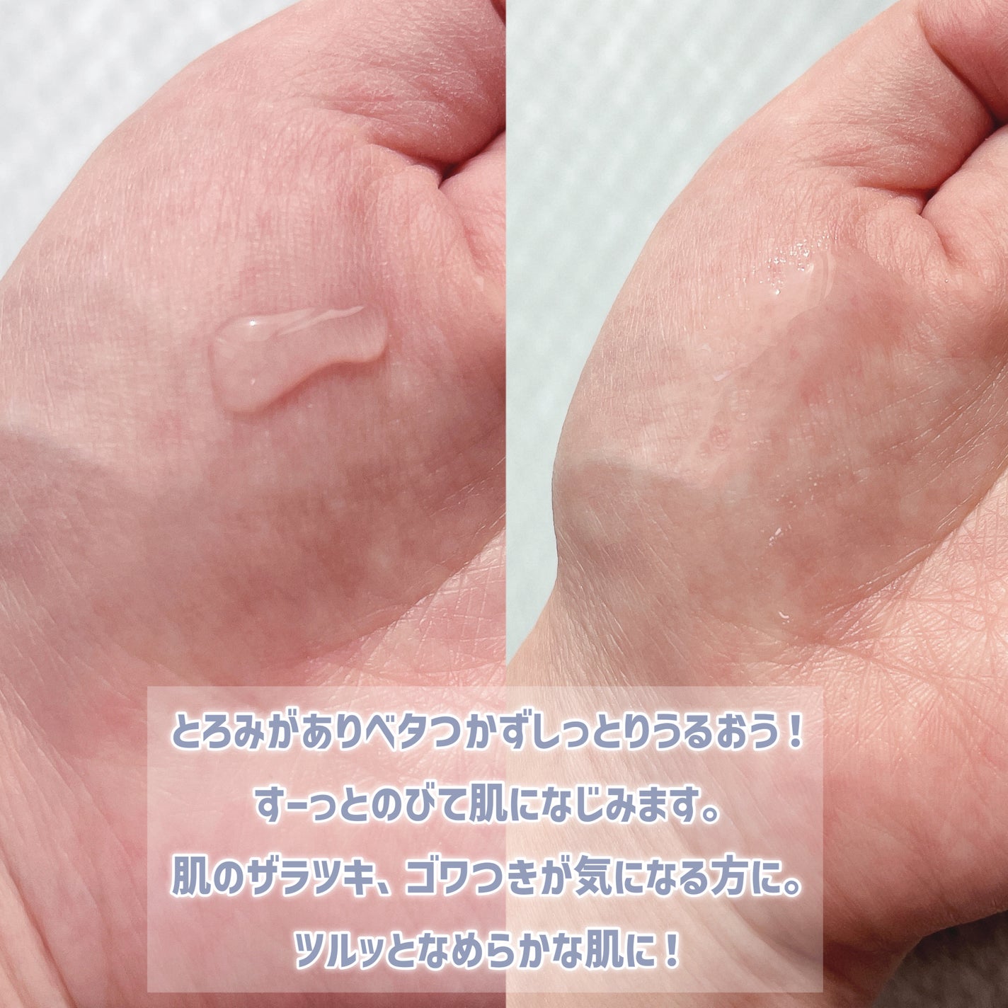 エファクラ ピールケア セラム/ラ ロッシュ ポゼ/美容液を使ったクチコミ(3枚目)