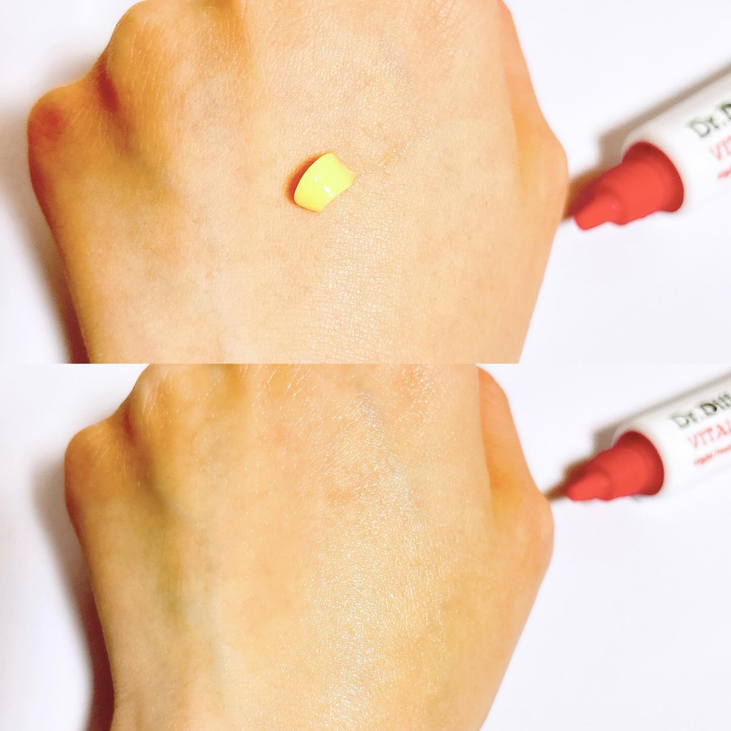 VITALIFT A forte/Dr.Different/フェイスクリームを使ったクチコミ（3枚目）