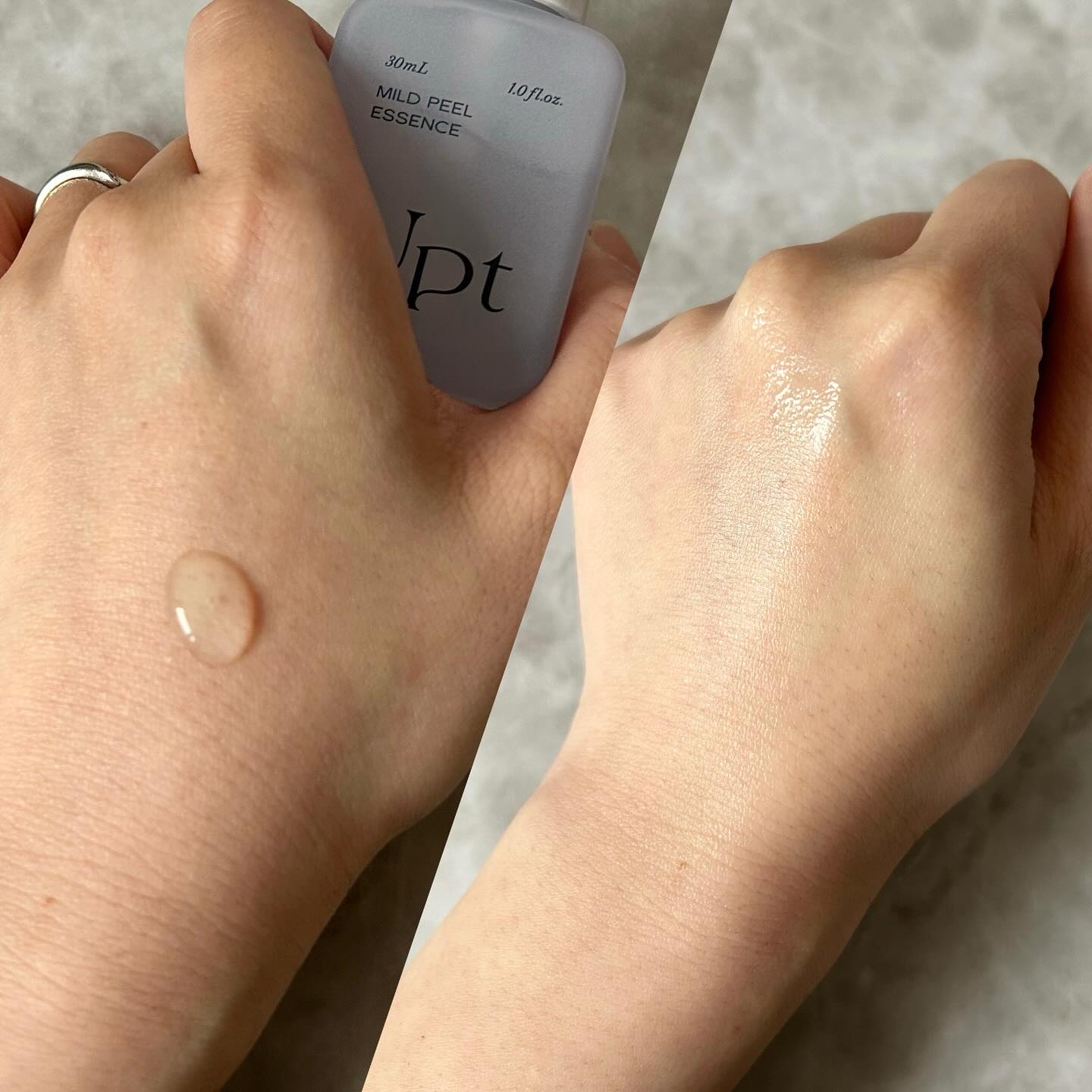 Upt MILD PEEL ESSENCE/Upt/ピーリングを使ったクチコミ（2枚目）