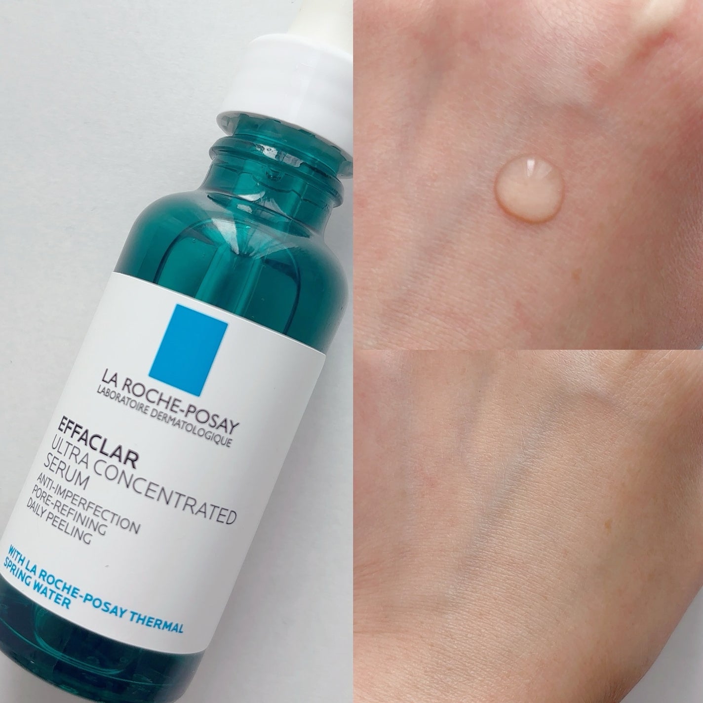 エファクラ ピールケア セラム/ラ ロッシュ ポゼ/美容液を使ったクチコミ(2枚目)