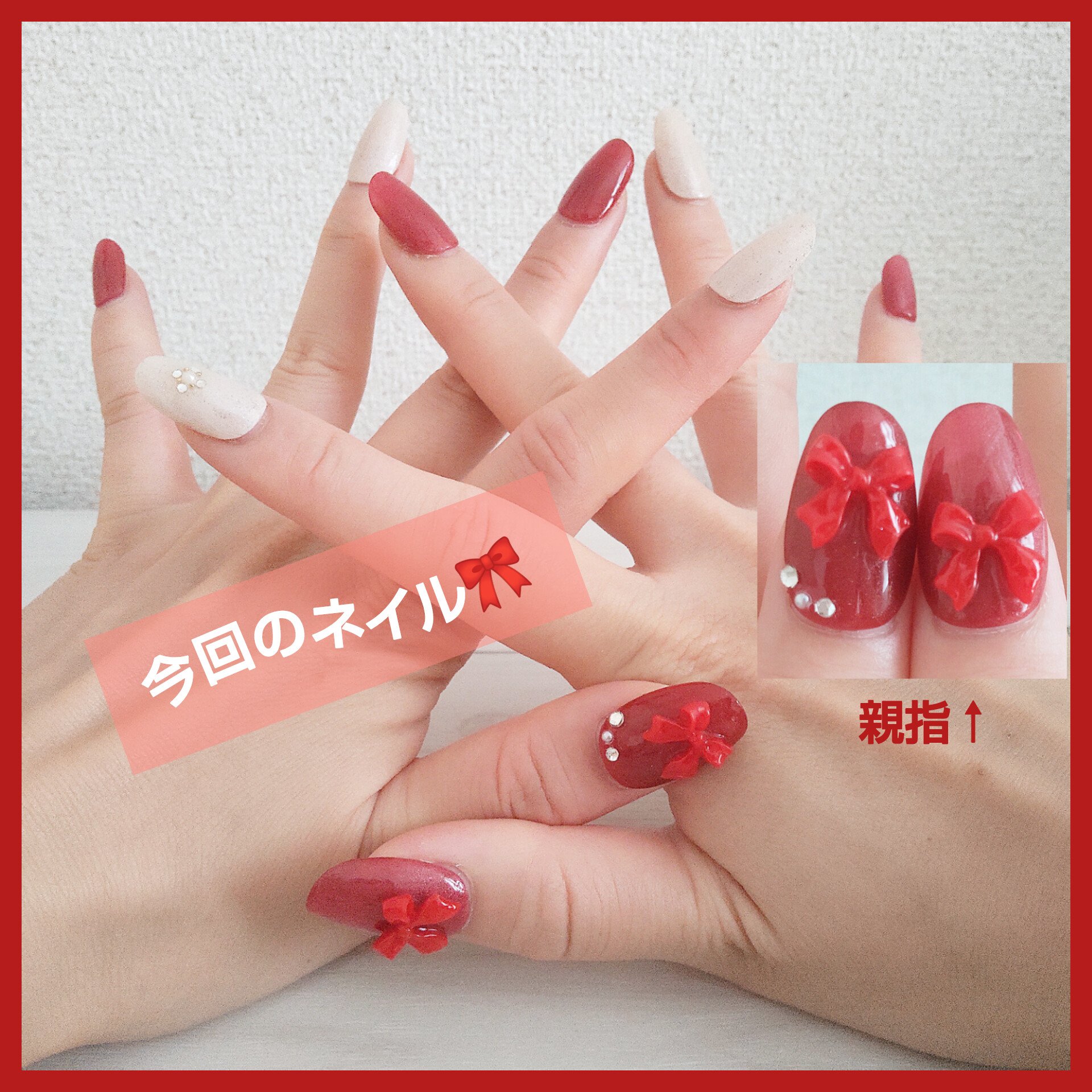 ネイルチップ/Anail/ネイルチップ・パーツを使ったクチコミ（1枚目）