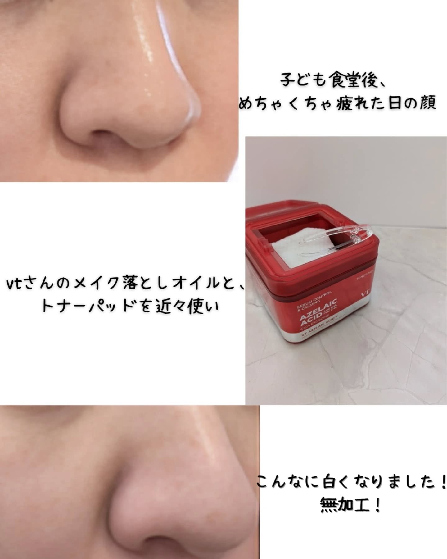 A1カーミング アンプル/VT/美容液を使ったクチコミ（2枚目）