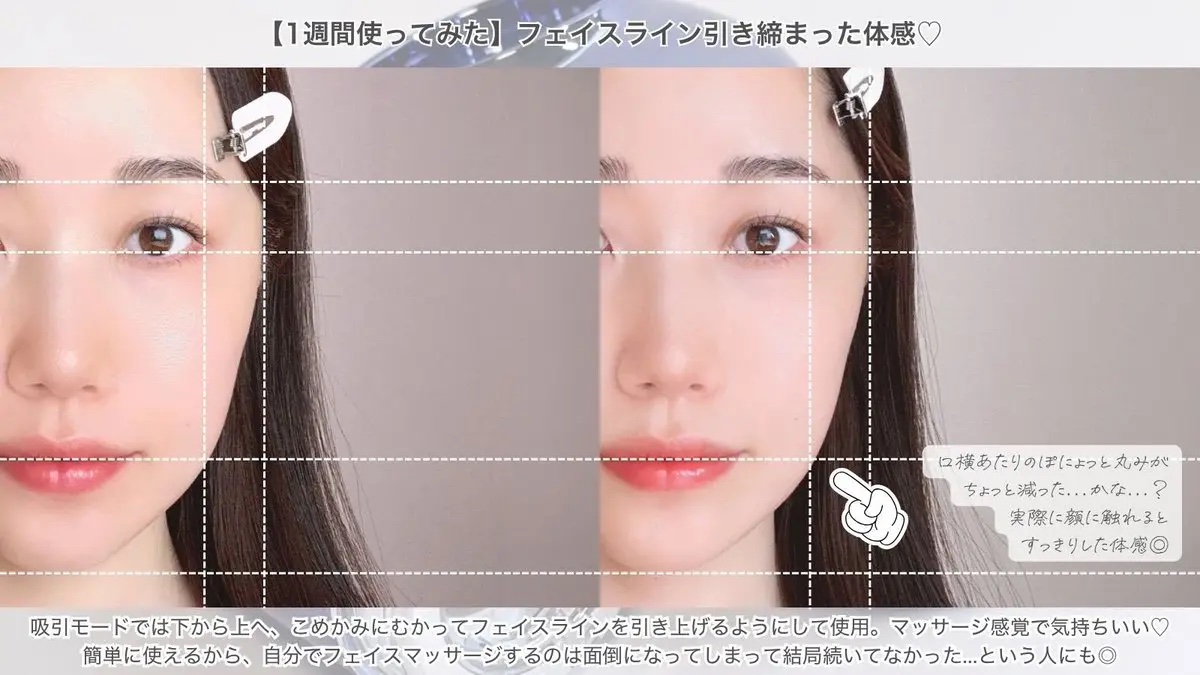 インモトックス小顔リフトアップペプチドショットクリーム＆吸引ジェット/MEDITHERAPY/フェイスクリームを使ったクチコミ（3枚目）