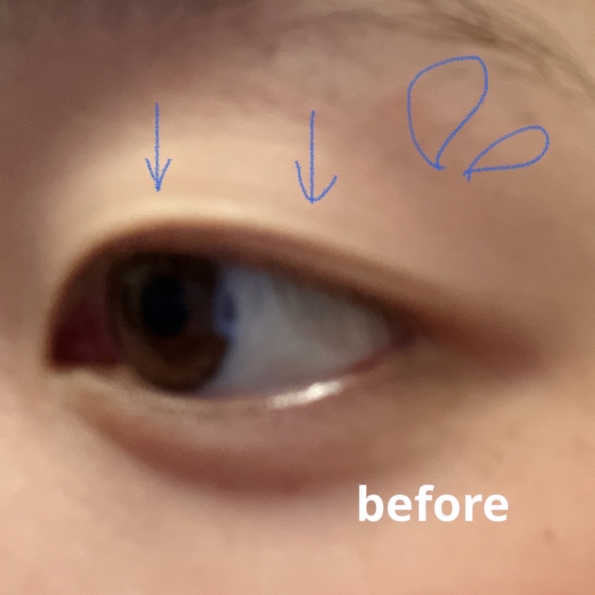 アイビューティー フィクサー WP/アストレア ヴィルゴ/二重まぶた用アイテムを使ったクチコミ（2枚目）