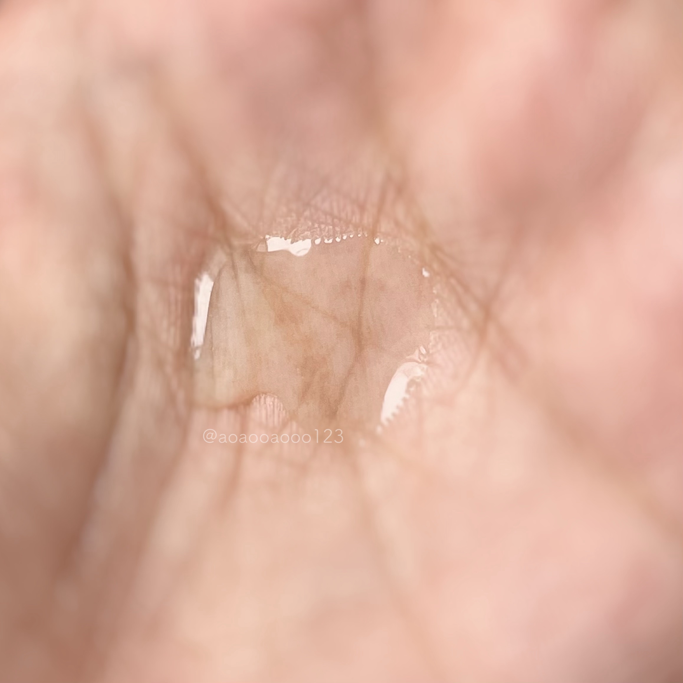 エファクラ ピールケア セラム/ラ ロッシュ ポゼ/美容液を使ったクチコミ（2枚目）