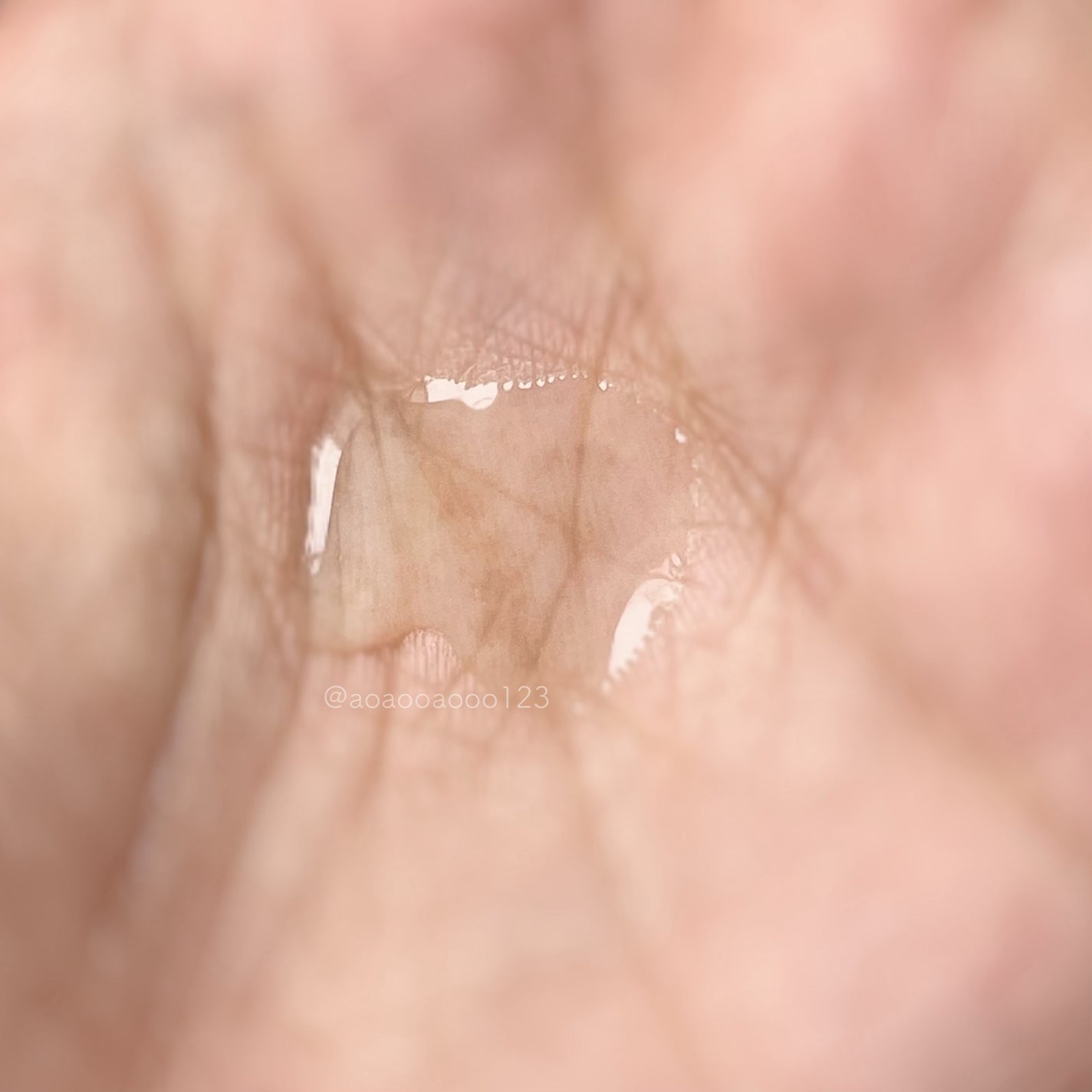 エファクラ ピールケア セラム/ラ ロッシュ ポゼ/美容液を使ったクチコミ(2枚目)