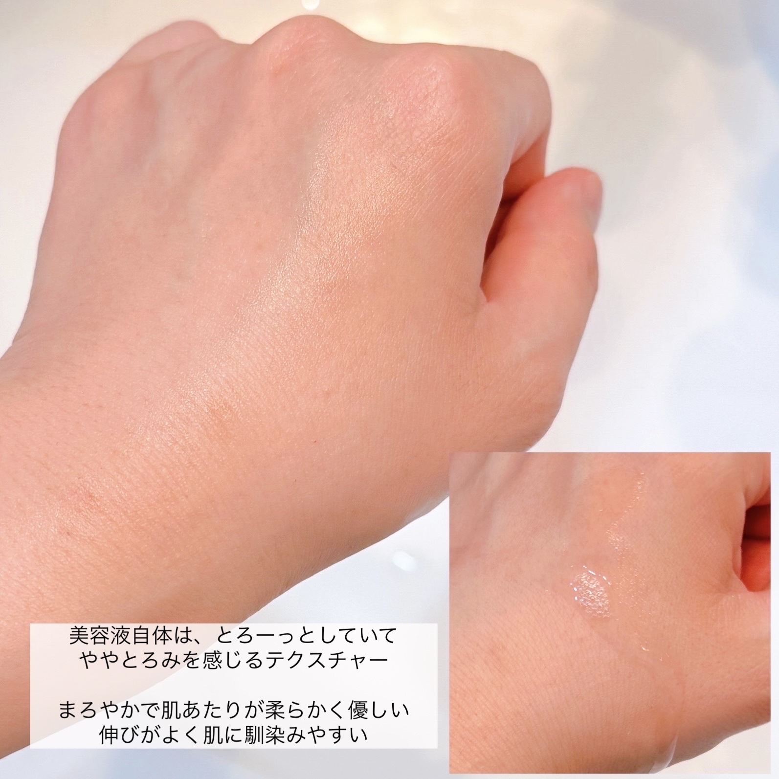 AZアゼライン酸10セラム/コスデバハ/美容液を使ったクチコミ（3枚目）