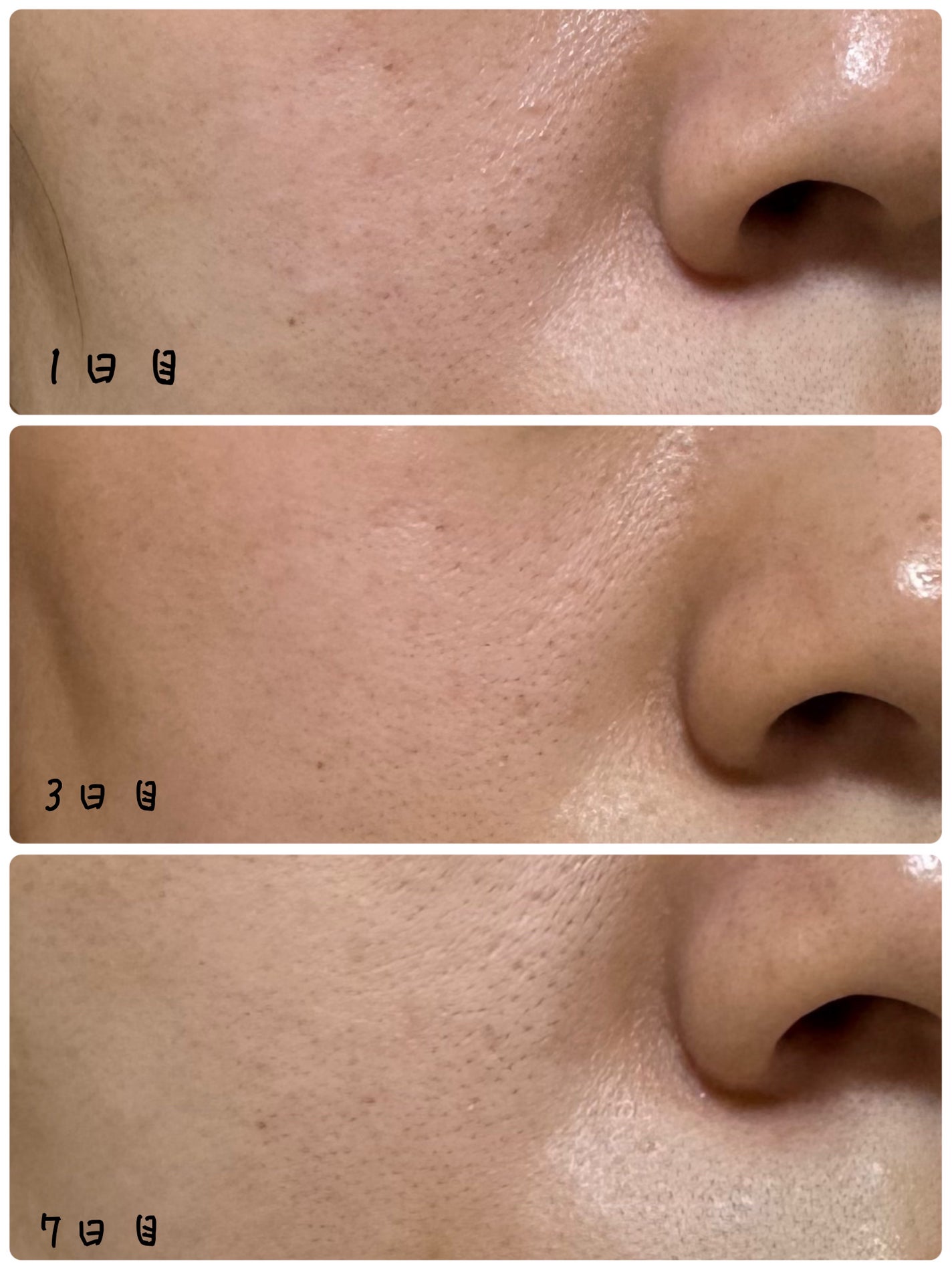 リードルS PDRN+ セラム/VT/美容液を使ったクチコミ(3枚目)