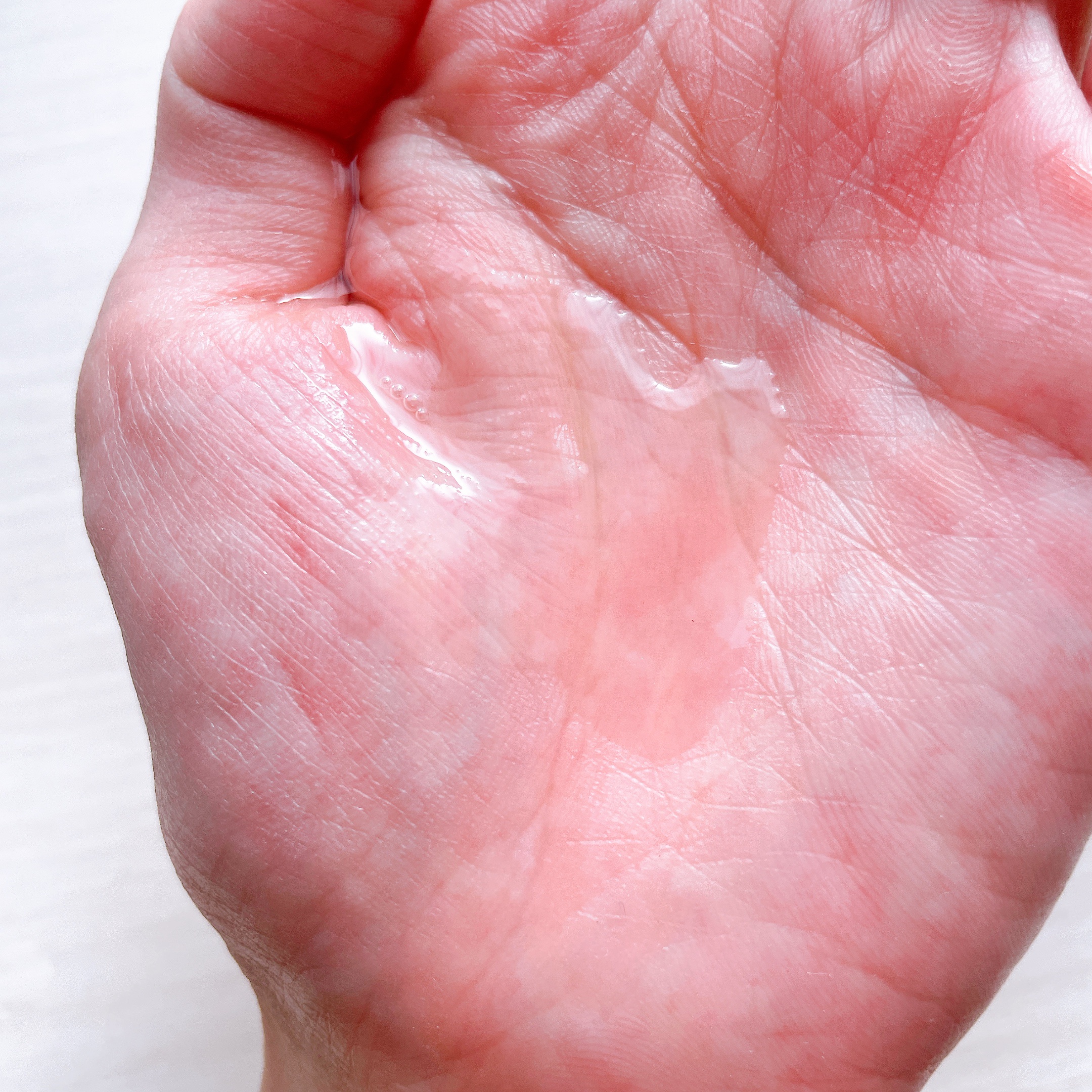 ティーツリーシカスージングトナー/BRING GREEN/化粧水を使ったクチコミ（3枚目）