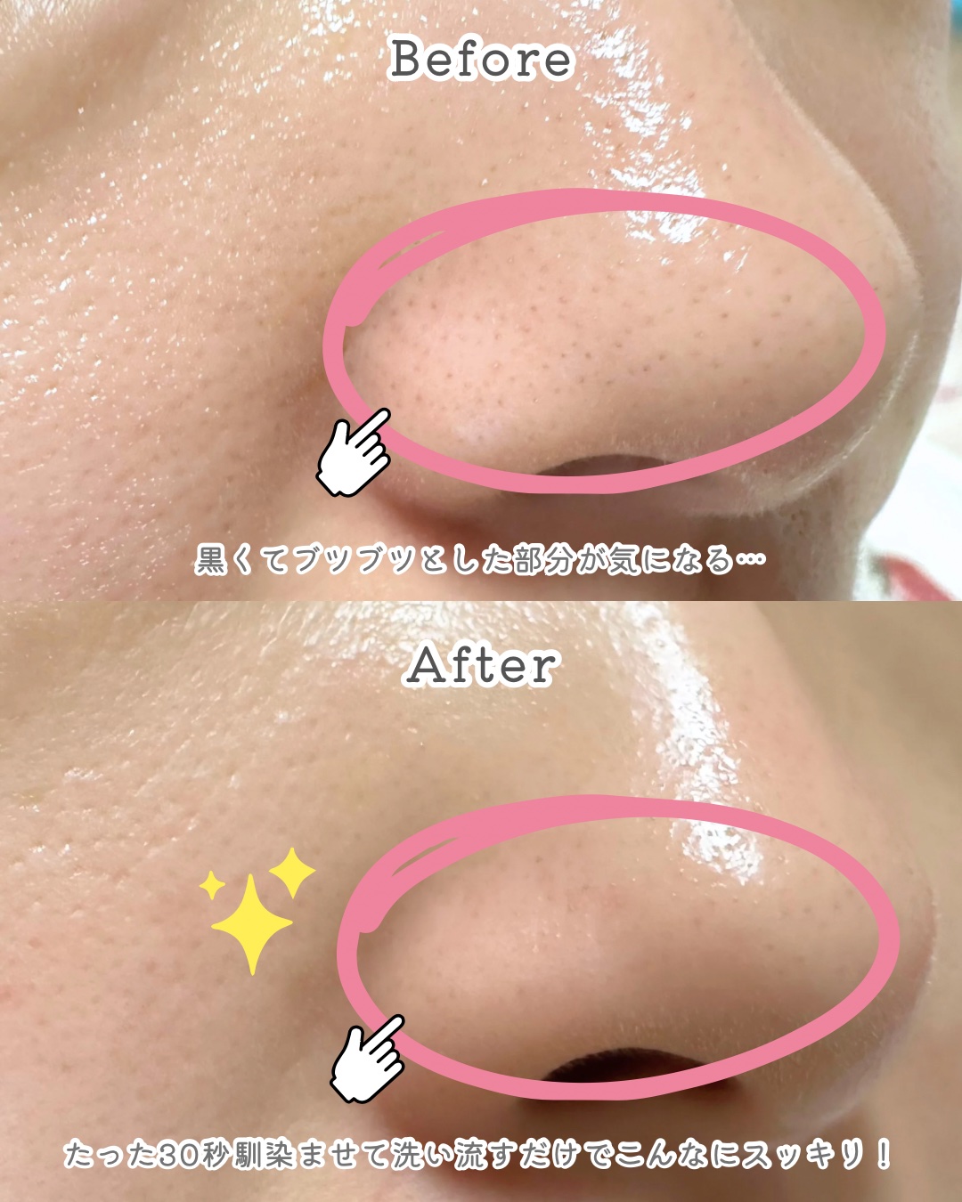 コスメデコルテ毛穴美容液オイル未開封 AQ 毛穴美容液オイル | DECORTÉ（コスメデコルテ）公式