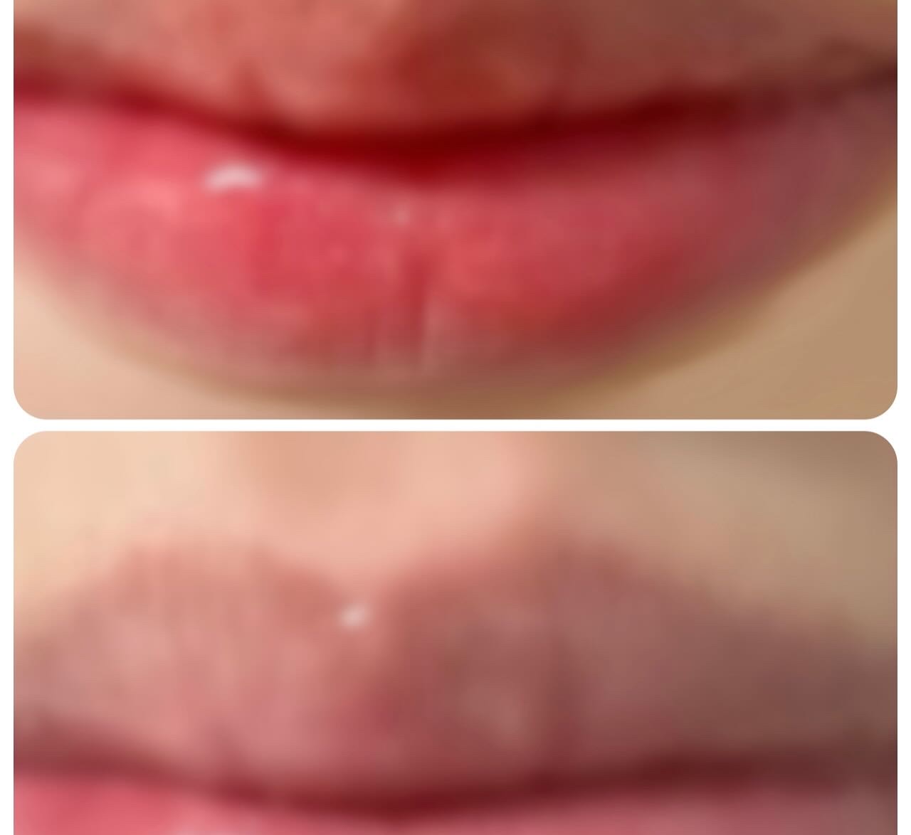 ウォーターフルリッププランパー/COSNORI/リッププランパーを使ったクチコミ（2枚目）