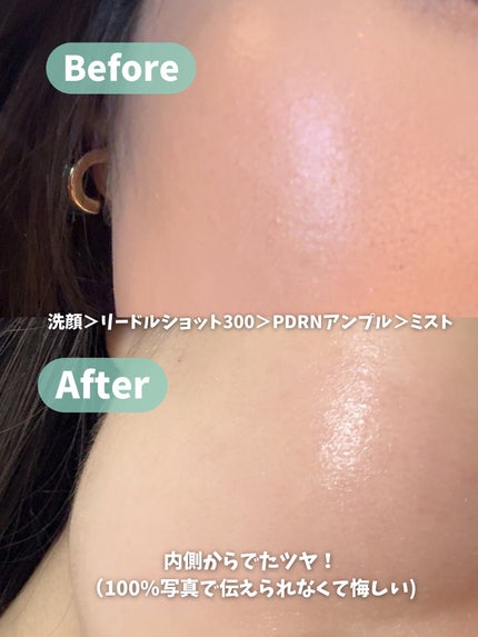 リードルS PDRN+ セラム/VT/美容液を使ったクチコミ(5枚目)