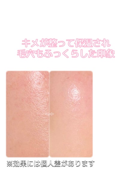 プロバイオダーム™ コラーゲン リモデリング ブースターショット プログラム/BIOHEAL BOH/美容液を使ったクチコミ(5枚目)