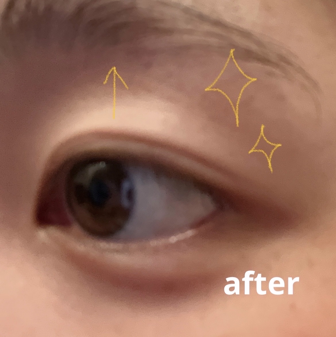 アイビューティー フィクサー WP/アストレア ヴィルゴ/二重まぶた用アイテムを使ったクチコミ（3枚目）