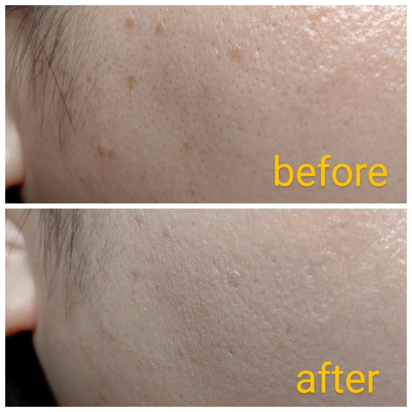 メラトーニングアンプル｜Easydew他、1商品を使った口コミ - Easydew様