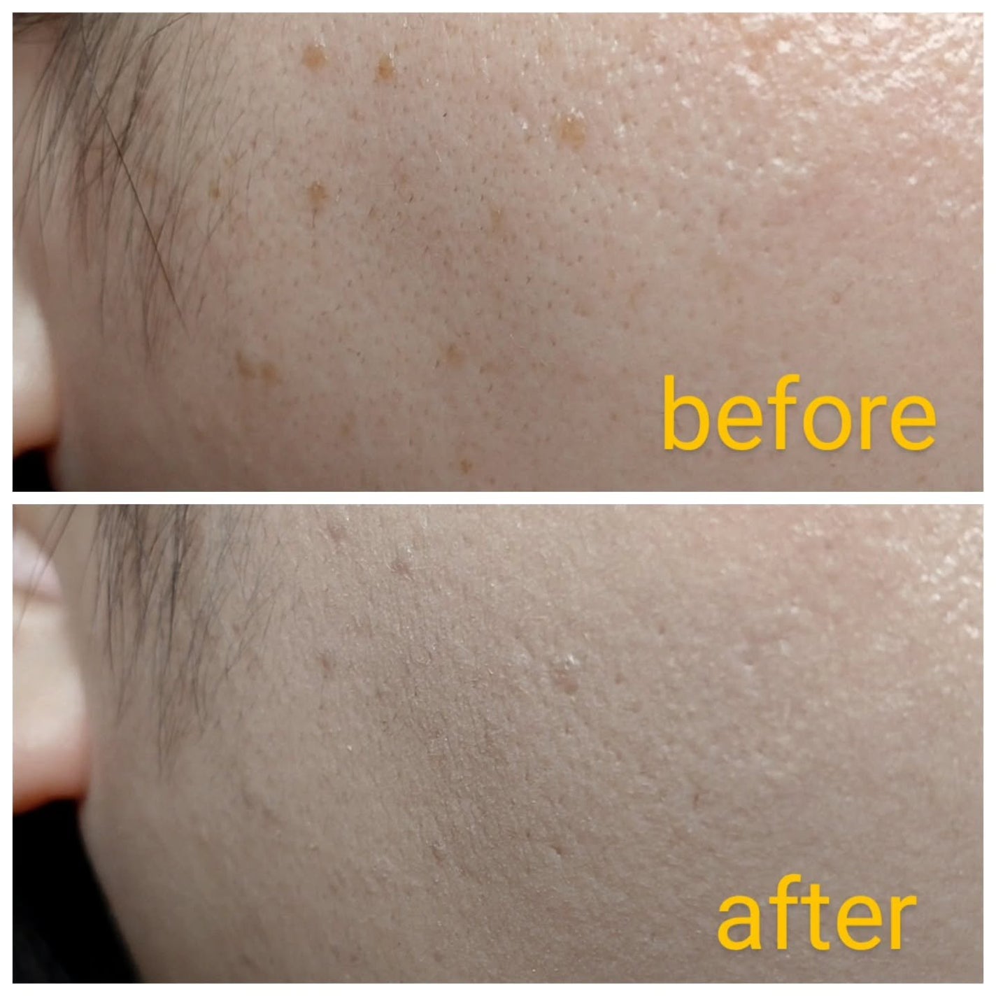 メラトーニングアンプル/Easydew/美容液を使ったクチコミ(4枚目)