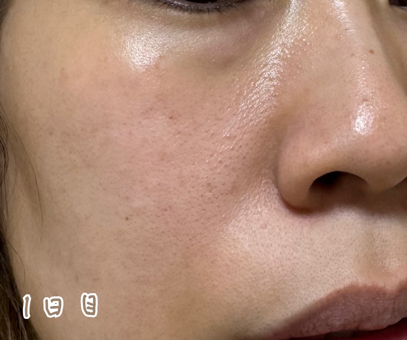 リードルS PDRN+ セラム/VT/美容液を使ったクチコミ(4枚目)