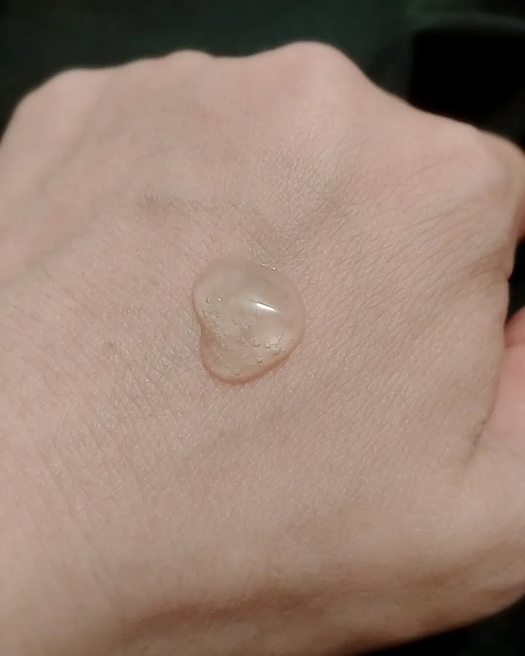 ブレミッシュケアアップ セラム/ISOI/美容液を使ったクチコミ(3枚目)