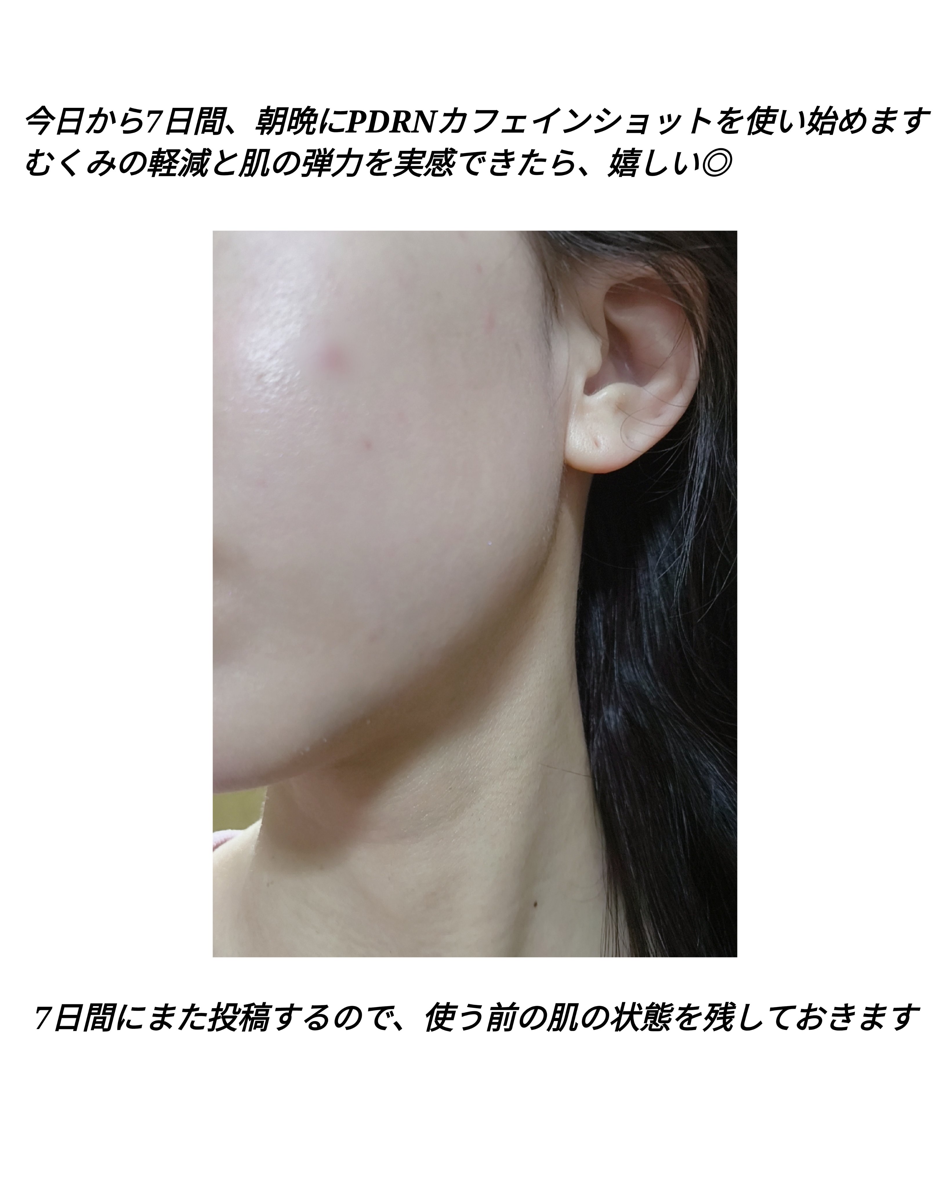 PDRNカフェインショット/IOPE/美容液を使ったクチコミ（2枚目）