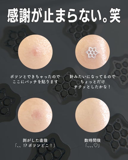 ACマグネシウムパッチ/スノーツープラス/シートマスク・パックを使ったクチコミ(3枚目)