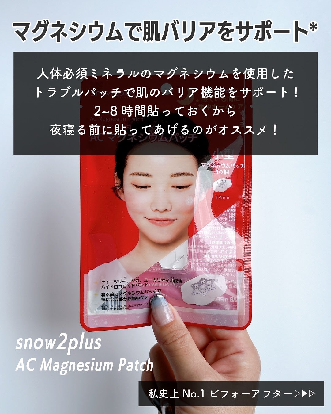 ACマグネシウムパッチ/スノーツープラス/シートマスク・パックを使ったクチコミ(2枚目)