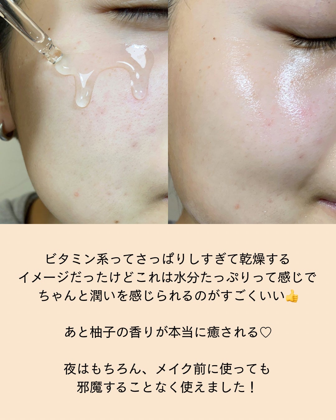 ビタ3セラム/オーズナリー/美容液を使ったクチコミ(5枚目)