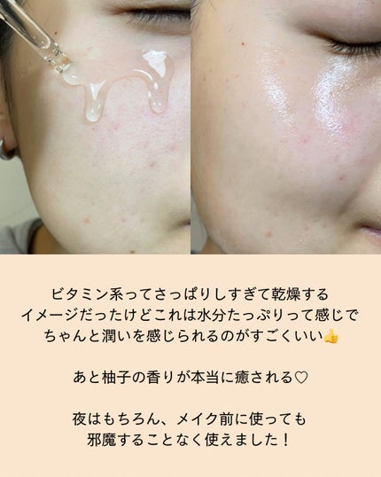 ビタ3セラム/オーズナリー/美容液を使ったクチコミ(5枚目)