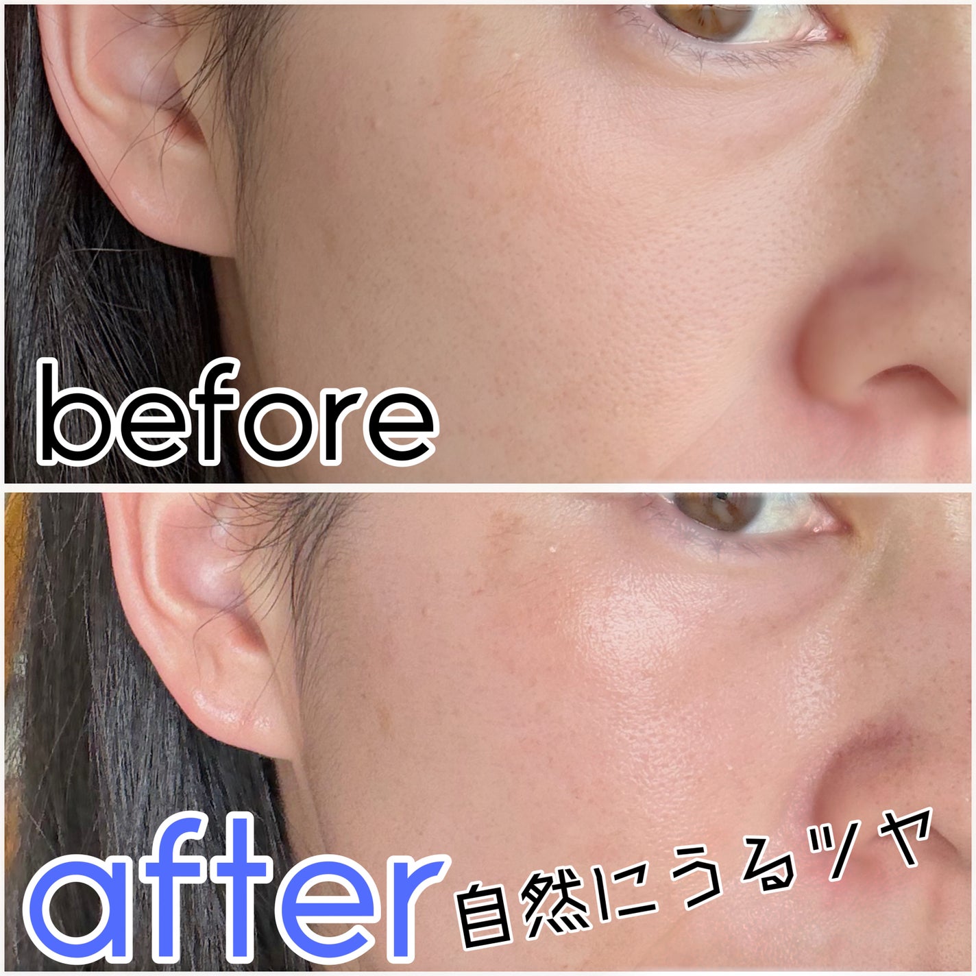 リードルS PDRN+ セラム/VT/美容液を使ったクチコミ(5枚目)