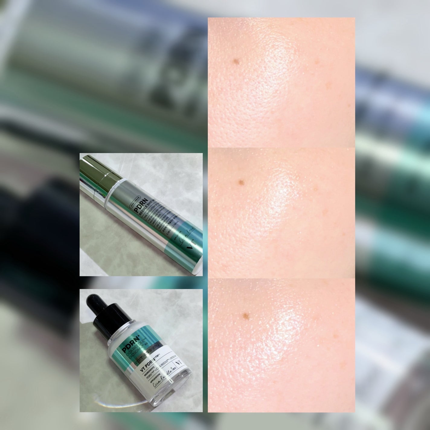 リードルS PDRN+ セラム/VT/美容液を使ったクチコミ(4枚目)