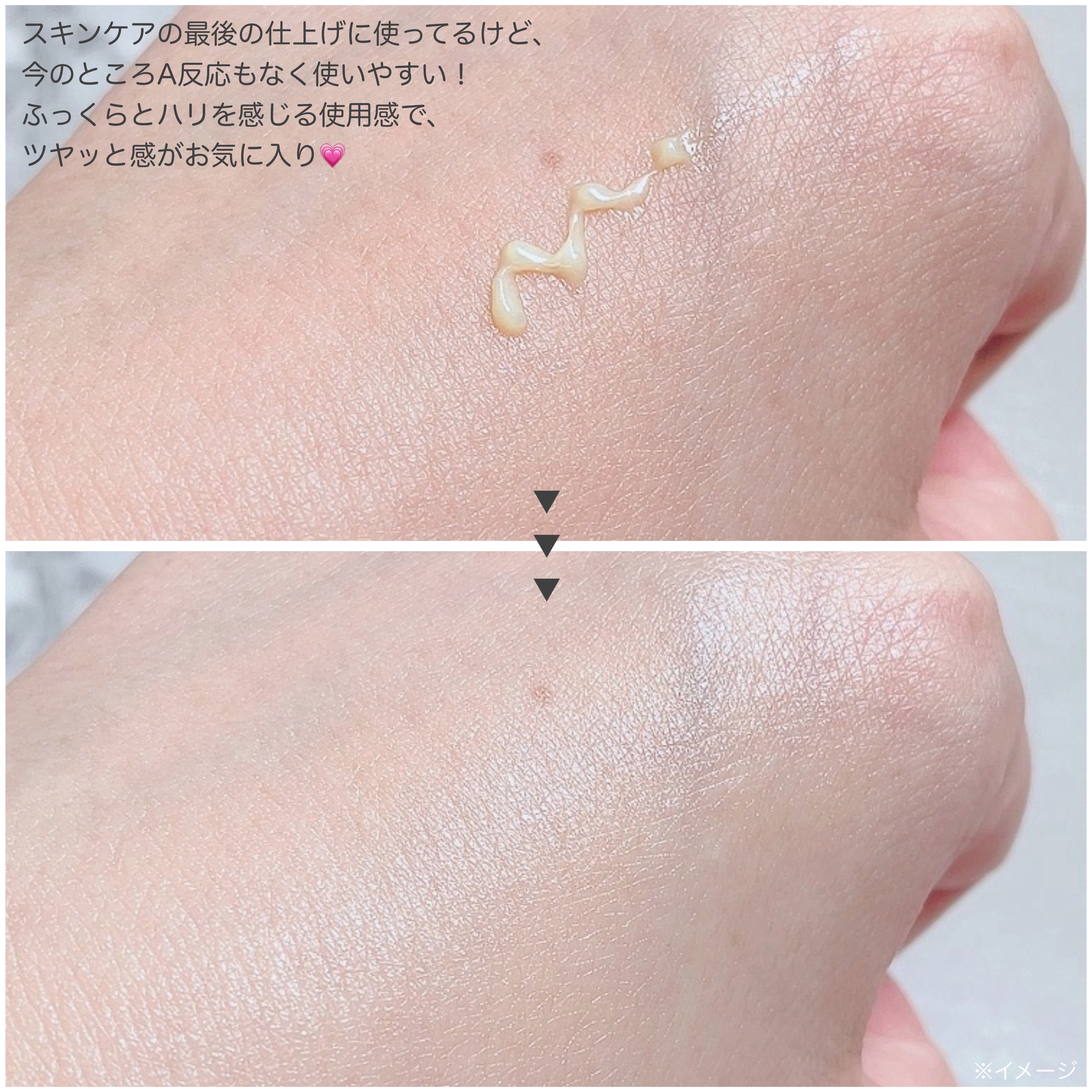 VITALIFT A forte/Dr.Different/フェイスクリームを使ったクチコミ（3枚目）