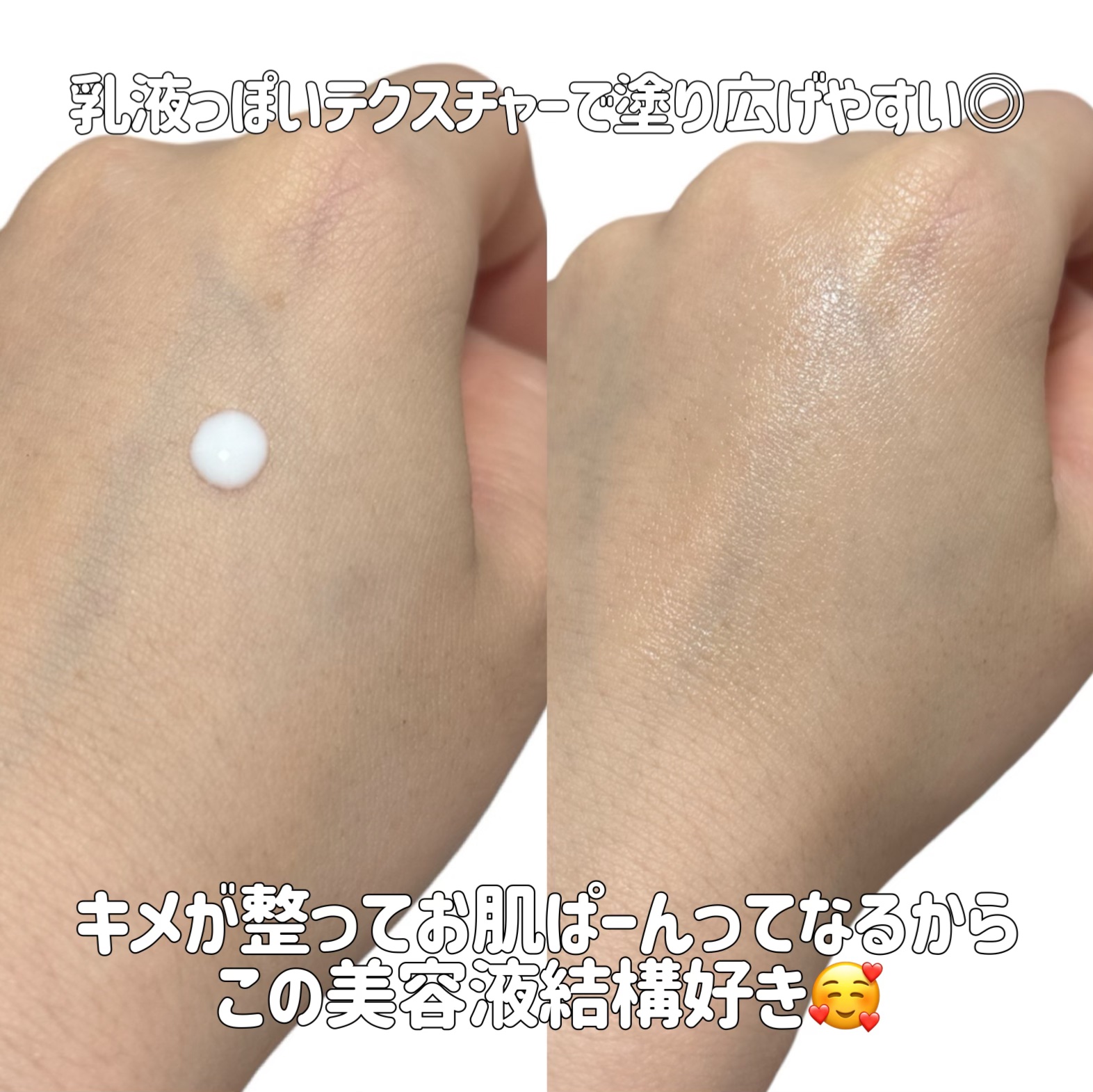 ピーディーアールエヌエッセンス PDRN 100/VT/美容液を使ったクチコミ（2枚目）