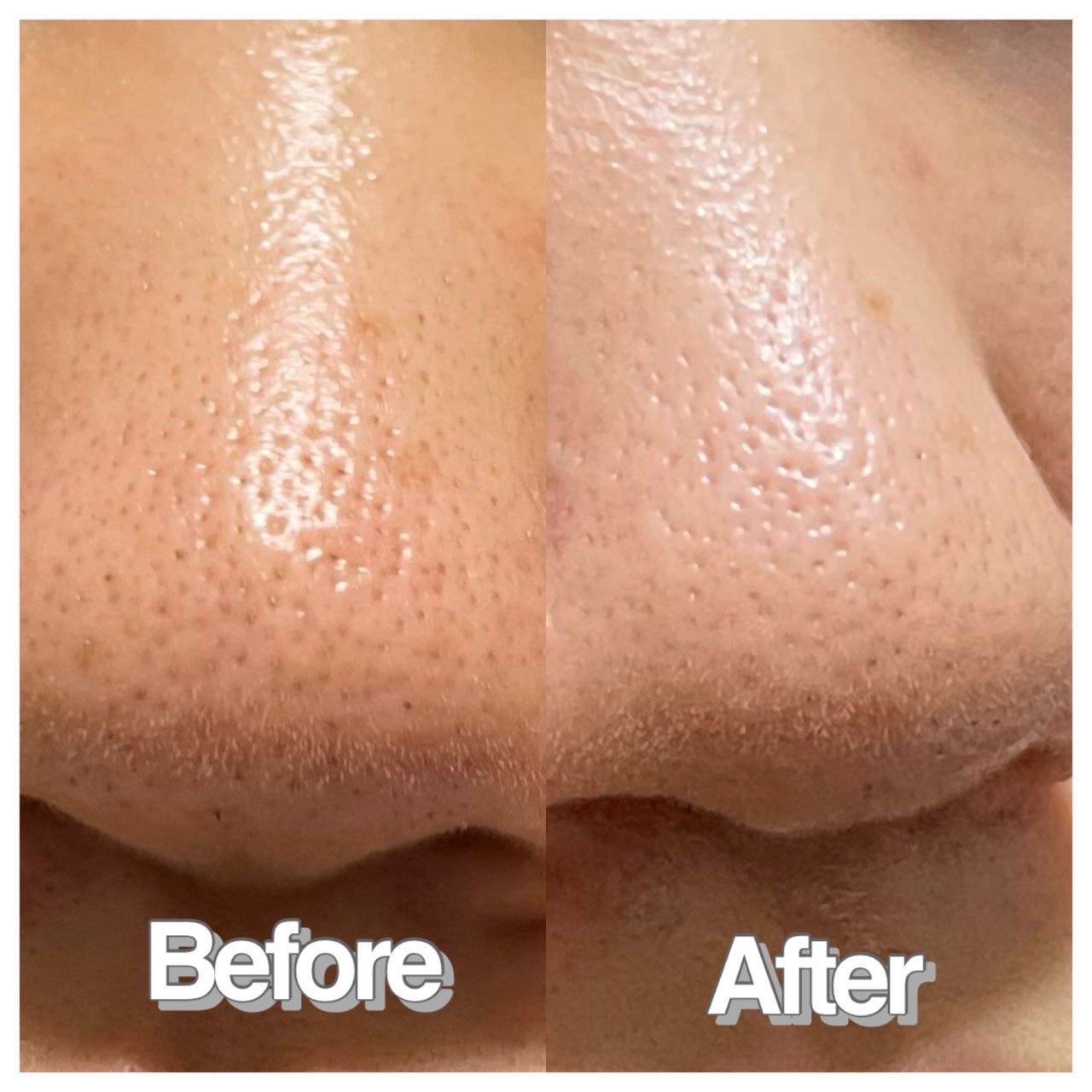 AZケア クレンジングオイル/VT/オイルクレンジングを使ったクチコミ(6枚目)