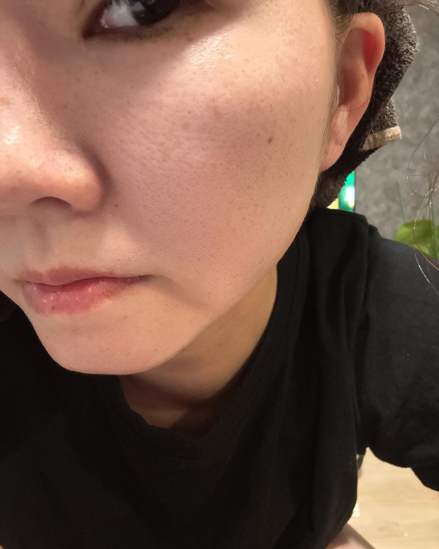 タカミスキンピール/タカミ/ブースター・導入液を使ったクチコミ(4枚目)