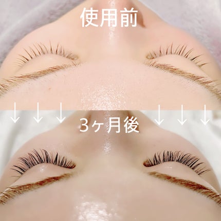 ラッシュアディクト アイラッシュコンディショニングセラム/soaddicted/まつげ美容液を使ったクチコミ(1枚目)