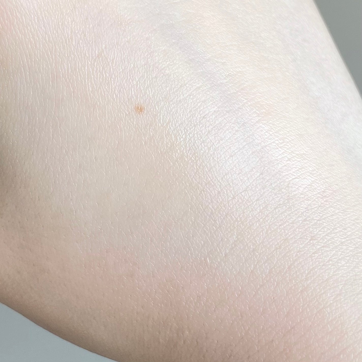 AZアゼライン酸15セラム/コスデバハ/美容液を使ったクチコミ(4枚目)