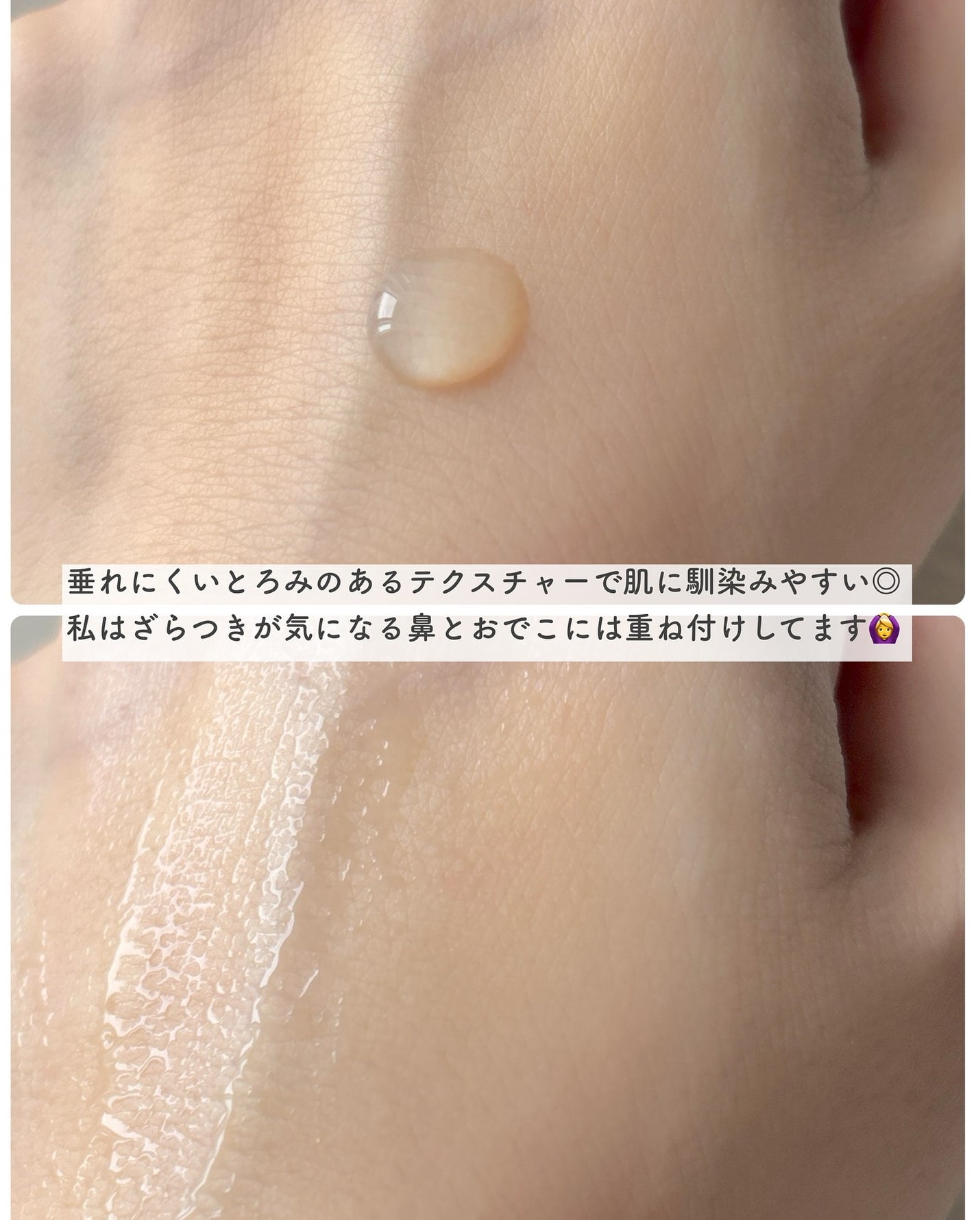 エファクラ ピールケア セラム/ラ ロッシュ ポゼ/美容液を使ったクチコミ(3枚目)