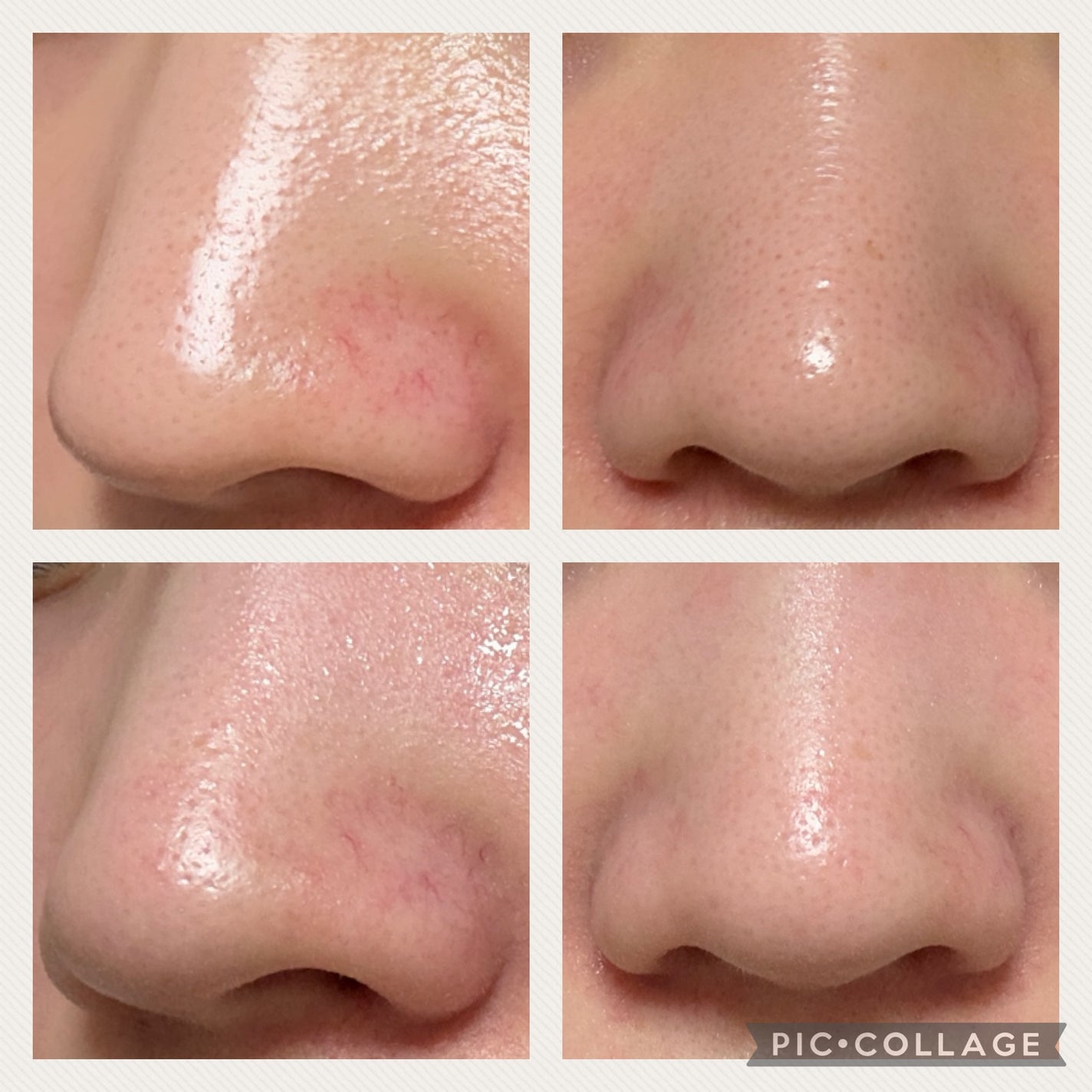 AZケア クレンジングオイル/VT/オイルクレンジングを使ったクチコミ(2枚目)