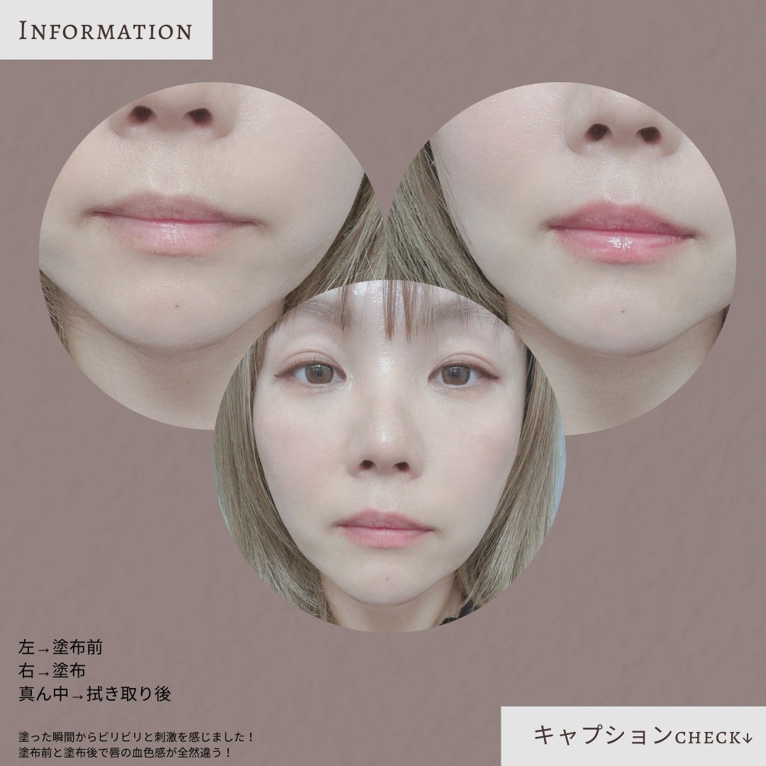 ニードルプランパー 電撃チェリー/Ui2./リッププランパーを使ったクチコミ(3枚目)