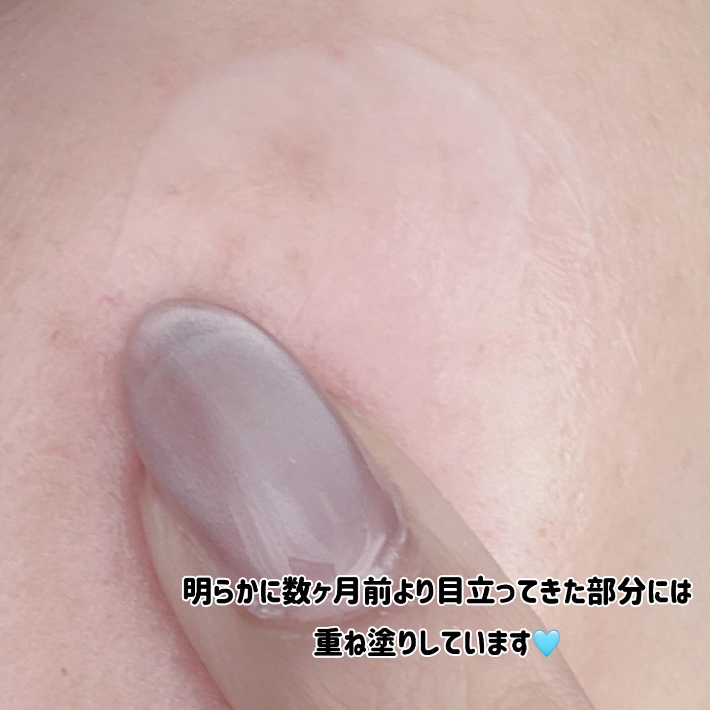 QuSomeホワイト2.0/b.glen/美容液を使ったクチコミ（3枚目）