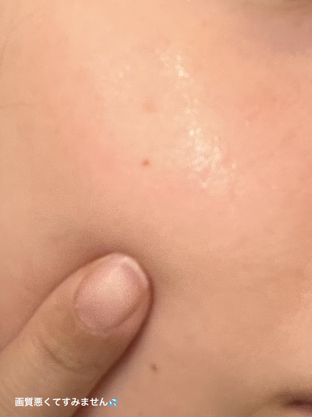 フォーミュラ　ファイアファイター10/It's skin/美容液を使ったクチコミ（2枚目）