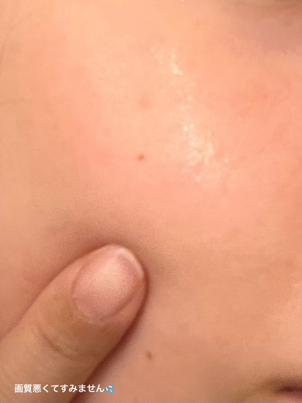 フォーミュラ ファイアファイター10/It's skin/美容液を使ったクチコミ(2枚目)