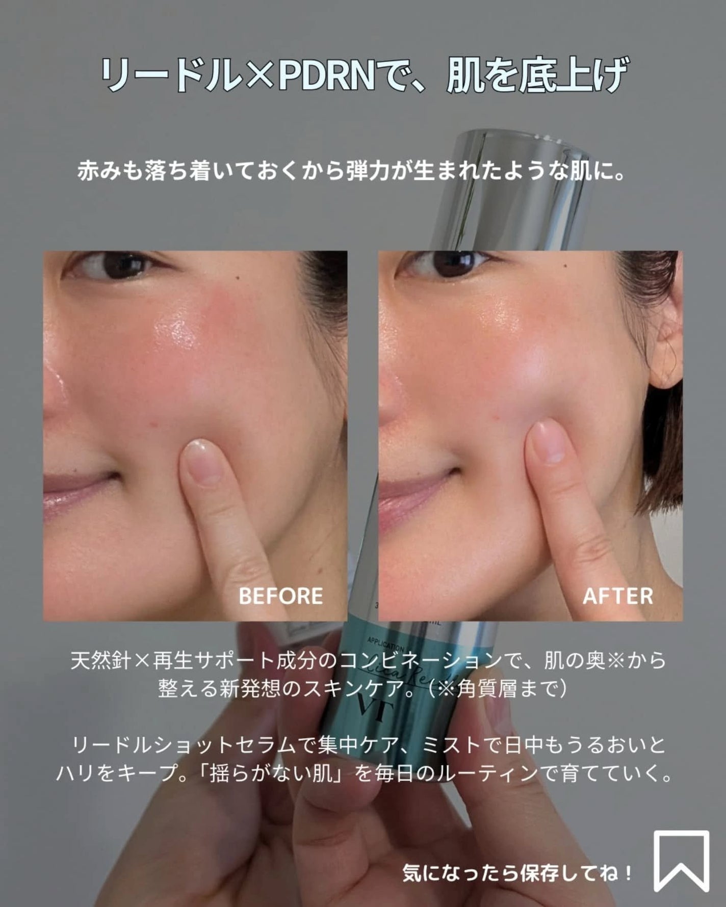 ナオホリック on LIPS 「ハリ・弾力、肌に差が出る2ステップ。“チクッと”がクセになる、..」(5枚目)