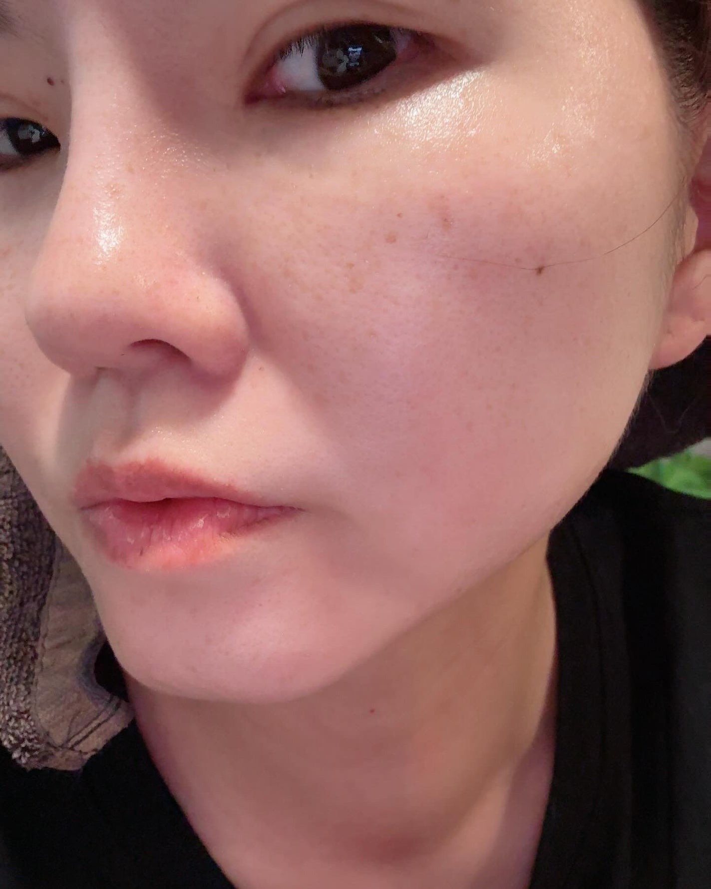 タカミスキンピール/タカミ/ブースター・導入液を使ったクチコミ(5枚目)