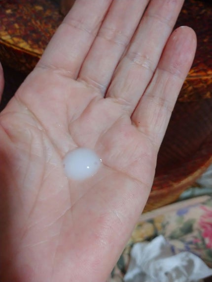 ニードルセラムA/fractionalCC/美容液を使ったクチコミ(2枚目)