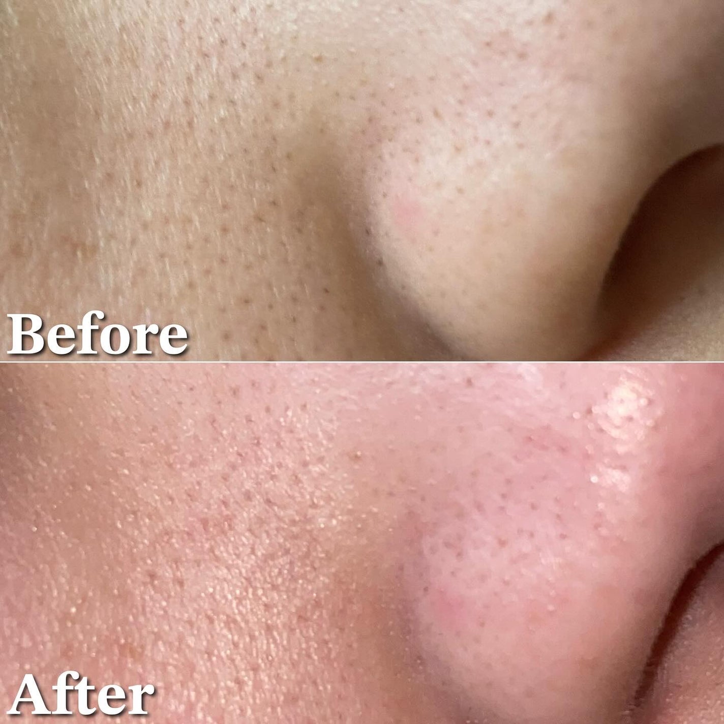 ホーリーバジル炭酸バブルパック/P.CALM/洗い流すパック・マスクを使ったクチコミ(8枚目)