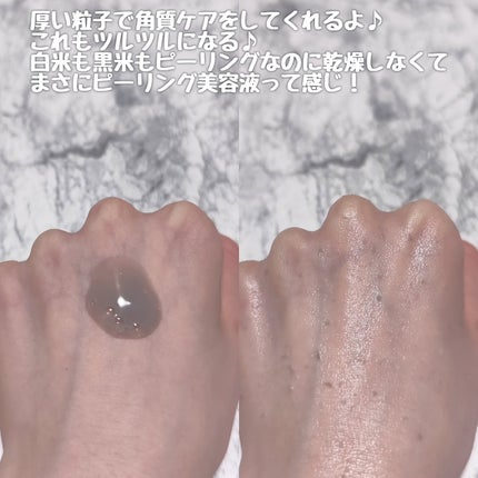 白米ピールショットゴマージュアンプル/Dr.Melaxin/美容液を使ったクチコミ(6枚目)