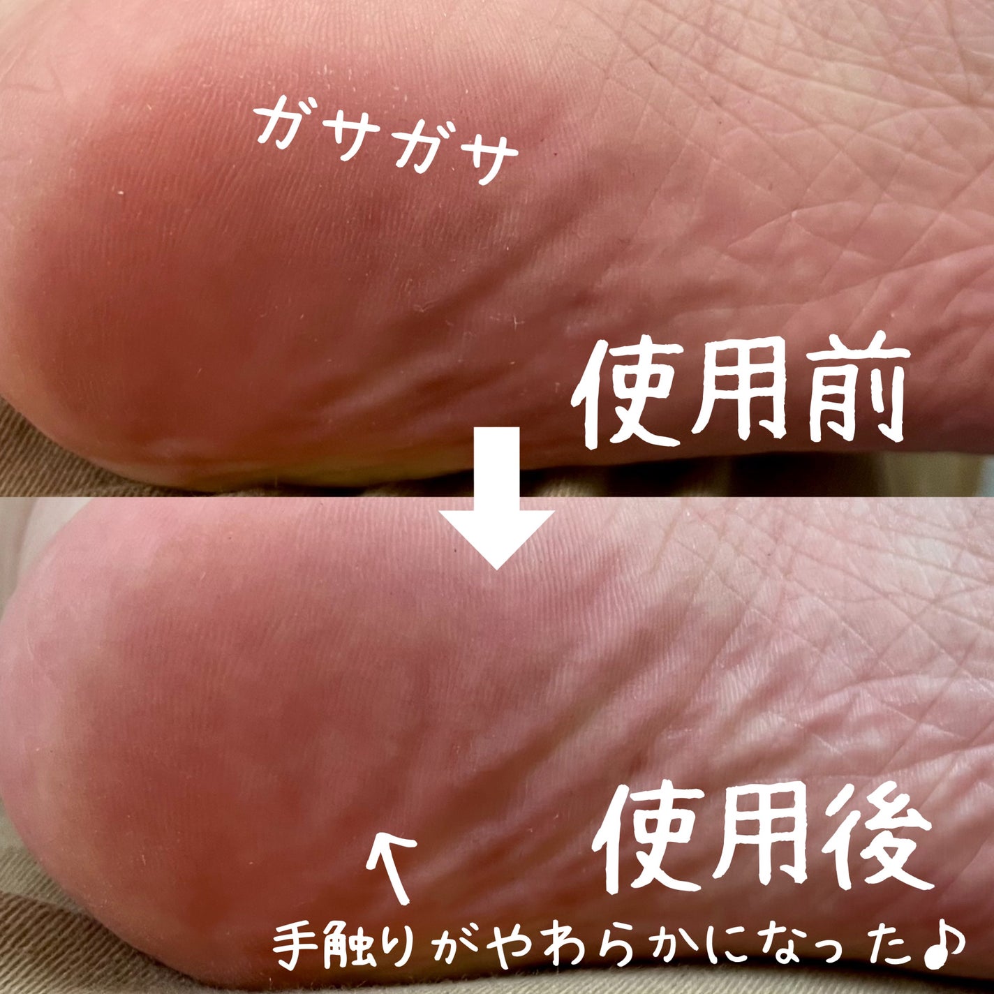 KOBAKO フットケアキット2(クールマッチャ)/KOBAKO/レッグ・フットケアを使ったクチコミ(7枚目)