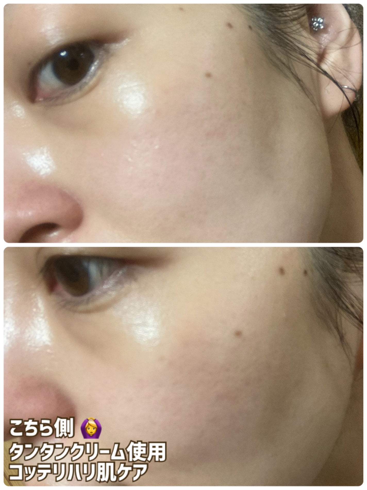 バイオヒールボ プロバイオダーム 3Dリフティングクリーム/BIOHEAL BOH/フェイスクリームを使ったクチコミ(5枚目)